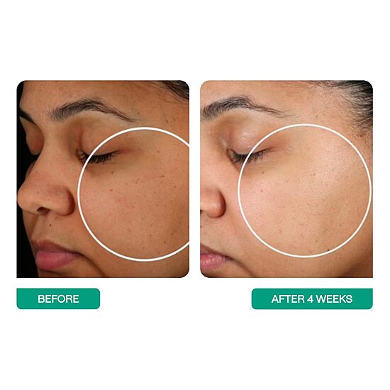 BeautyStat Universal Pro-Bio Moisture Boost Cream