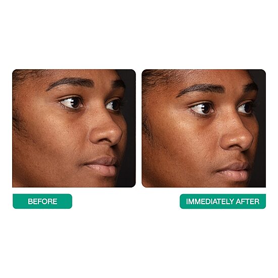 BeautyStat Triple-Plump Coconut Milk Serum Face Serum