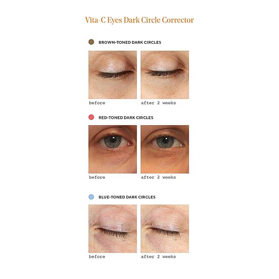 Murad Vita C Dark Circle Corrector Eye Cream