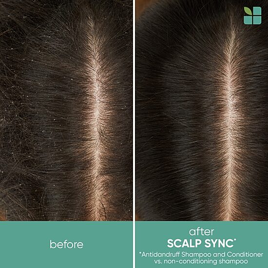 Biolage Scalp Sync Anti-Dandruff Shampoo 33.8 oz.
