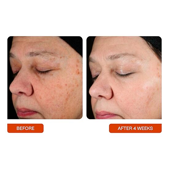 BeautyStat Universal C Skin Refiner Face Serum