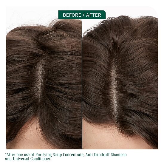Biolage Scalp Sync Anit-Dandruff Shampoo 13.5 oz.