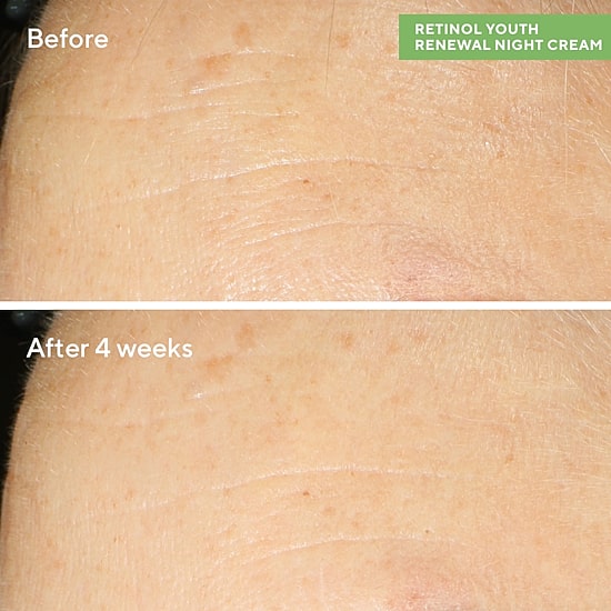 Murad Retinol Youth Renewal Face Serum
