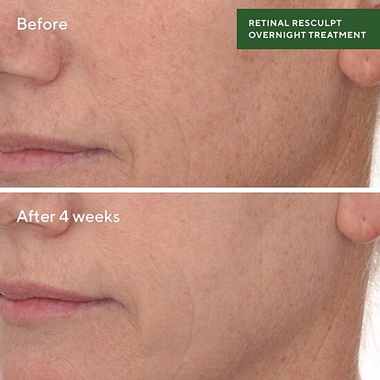 Murad Retinal Resculpting Overnight Treatment Facial Treatment