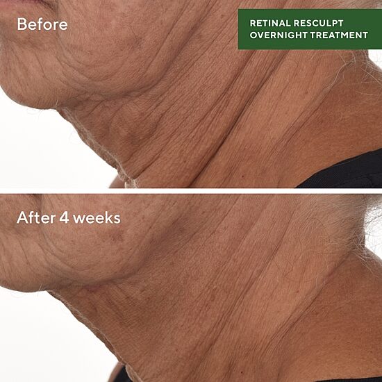 Murad Retinal Resculpting Overnight Treatment Facial Treatment