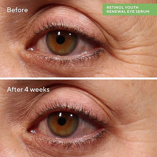 Murad Retinol Youth Renewal Eye Serum