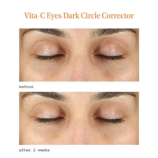 Murad Vita C Dark Circle Corrector Eye Cream
