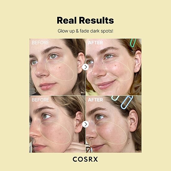 Cosrx The Vitamin C 23 Serum Face Serum