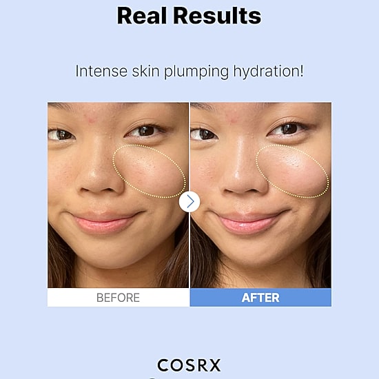 Cosrx The Hyaluronic Acid 3 Serum Face Serum