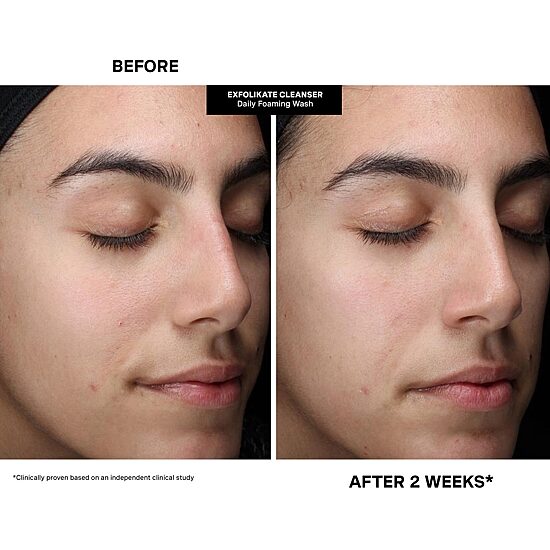Kate Somerville Pore-Fect Skin Edit ($51 Value)