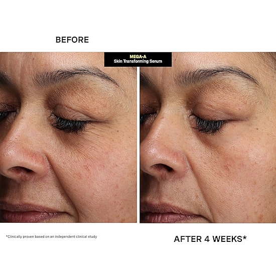 Kate Somerville Face Serum