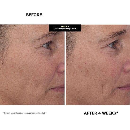 Kate Somerville Face Serum