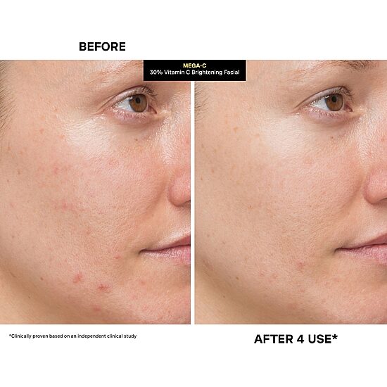 Kate Somerville Mega-C® 30% Vitamin C Brightening Facial