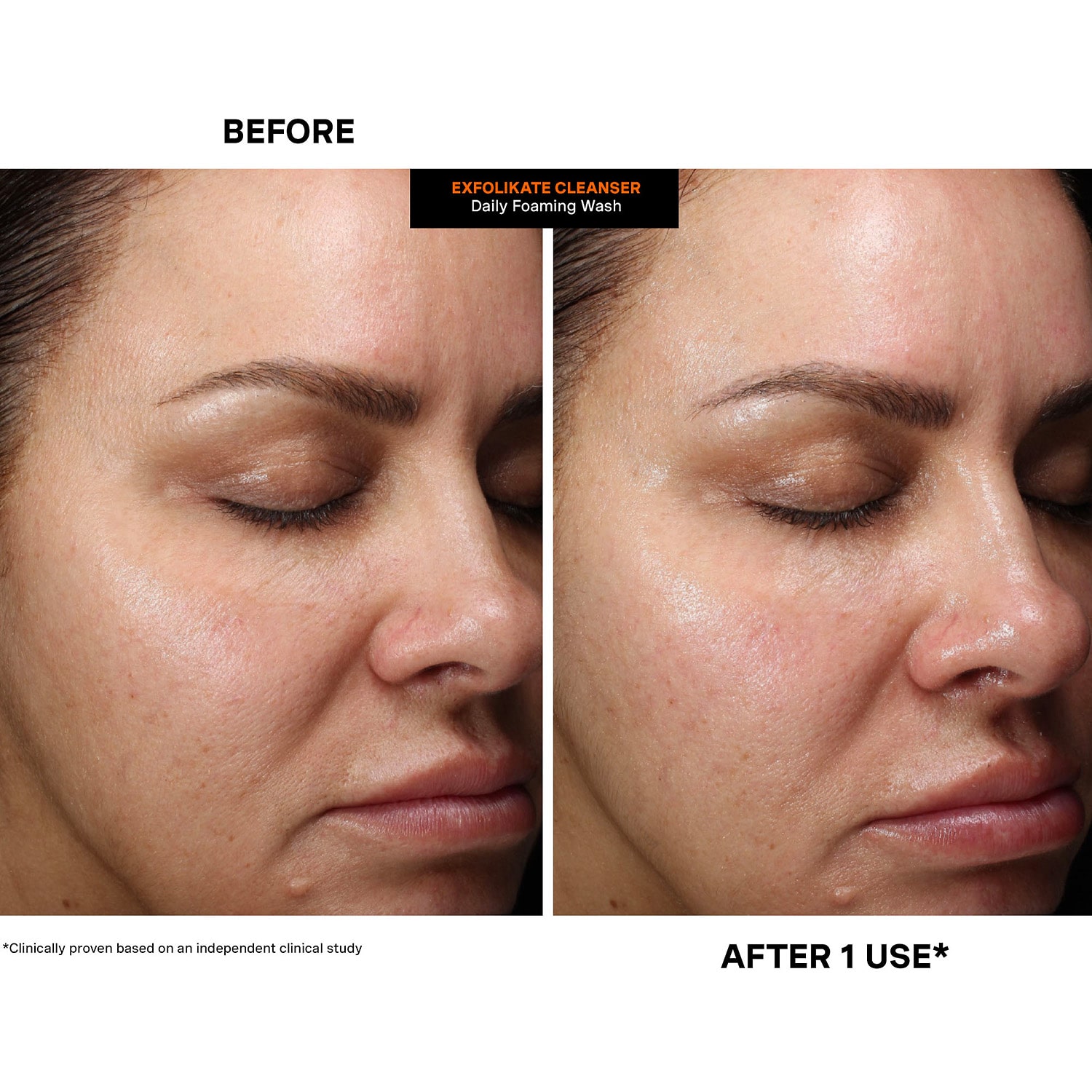 Kate Somerville Facial Cleanser