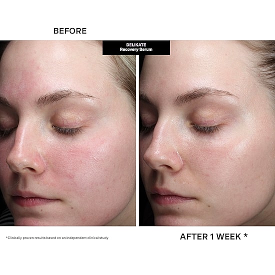 Kate Somerville Delikate® Recovery Serum Face Serum