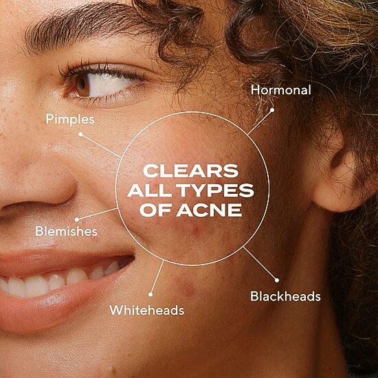 Murad Biome-Balancing Clear & Prevent Acne Treatment Serum