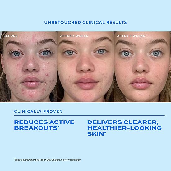 Murad Biome-Balancing Clear & Prevent Acne Treatment Serum