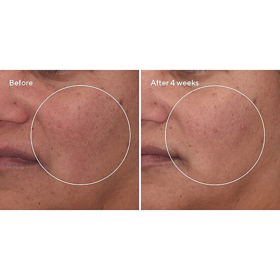 Murad Cellular Hydration Barrier Repair Serum Face Serum