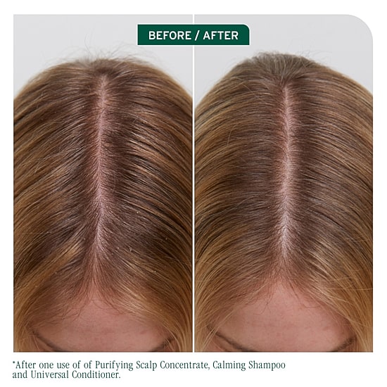 Biolage Scalp Sync Universal Conditioner 8 oz.