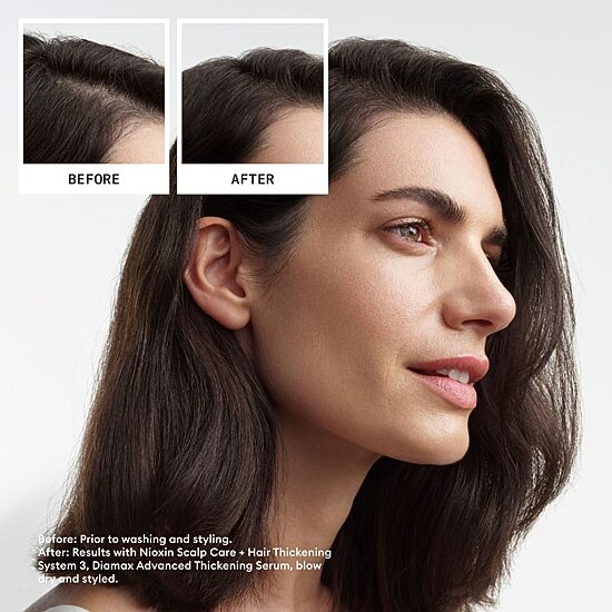 Nioxin® System 3 Scalp + Hair Shampoo 33.8 oz.