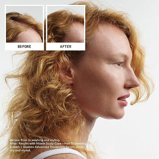 Nioxin® System 1 Scalp Care + Hair Conditioner 33.8 oz.