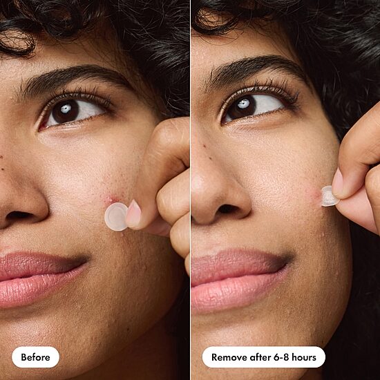 Hero Cosmetics Mighty Patch Duo 12 Count