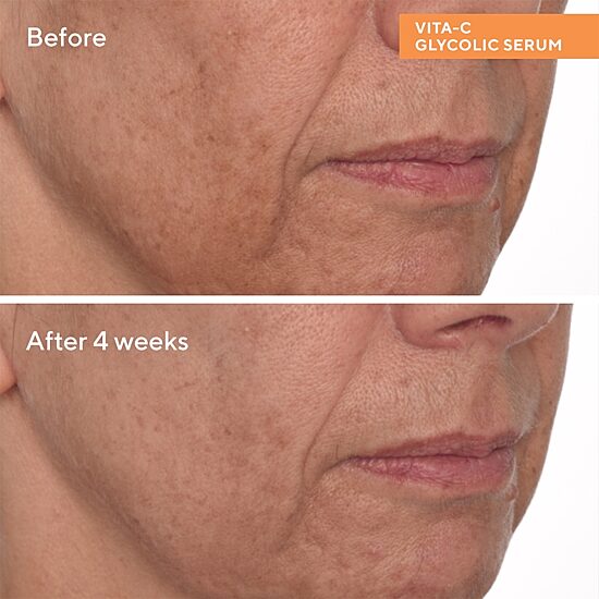 Murad Vita-C Glycolic Brightening Serum Face Serum