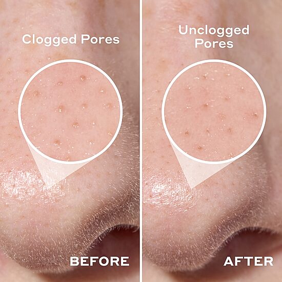 Mario Badescu Facial Treatment