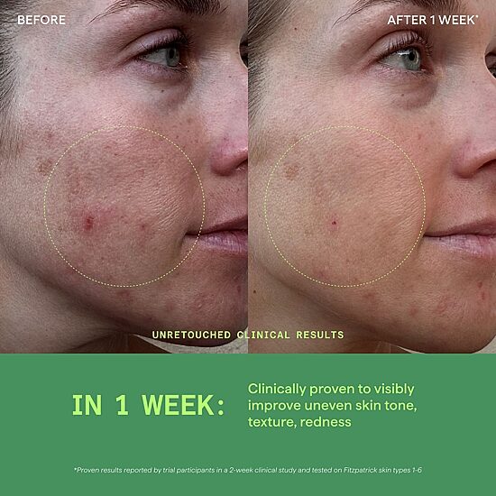 Murad Biome-Balancing Calm + Recover Cream