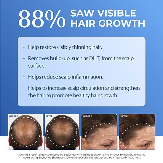 BosleyMD Bosrevive Nct Shampoo 33.8 oz.