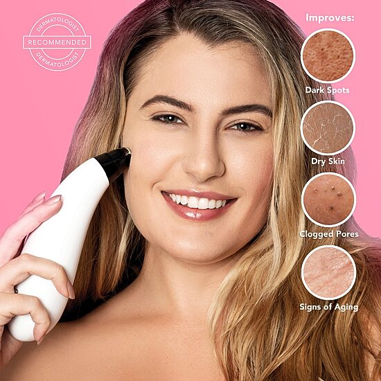 Spa Sciences Mio Microdermabrasion And Pore Extraction Skin Resurfacing System