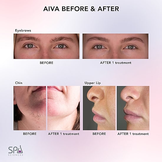 Spa Sciences Aiva Epilator – Facial Hair Remover & Eyebrow Trimmer