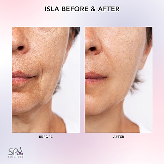 Spa Sciences Isla Sonic Face & Body Roller Contouring System