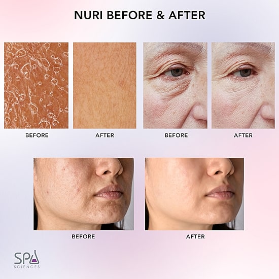 Spa Sciences Nuri Led Thermal Smart Facial Skincare Mask Infuser