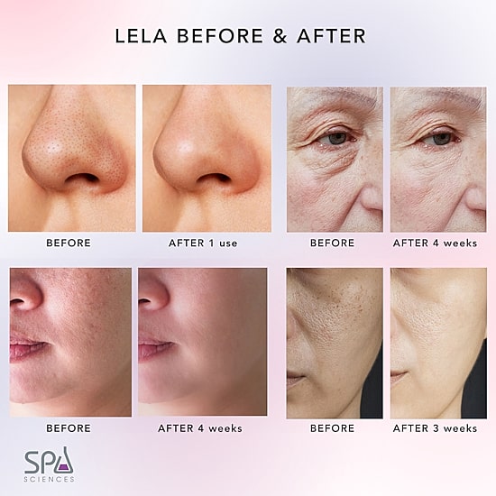 Spa Sciences Lela Ultrasonic Skin Spatula