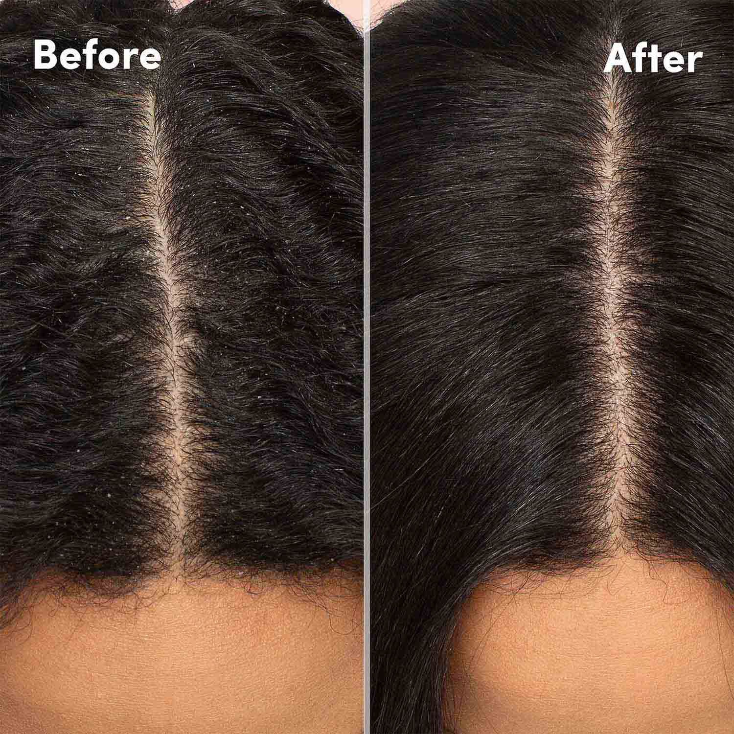 Mizani Scalp Care Shampoo 16.9 oz.