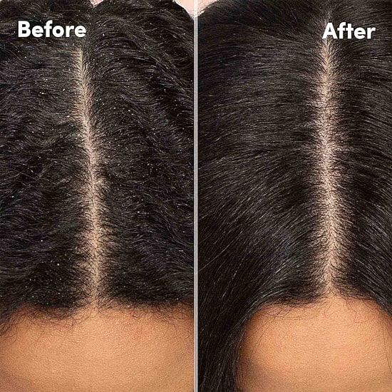 Mizani Scalp Care Shampoo 16.9 oz.