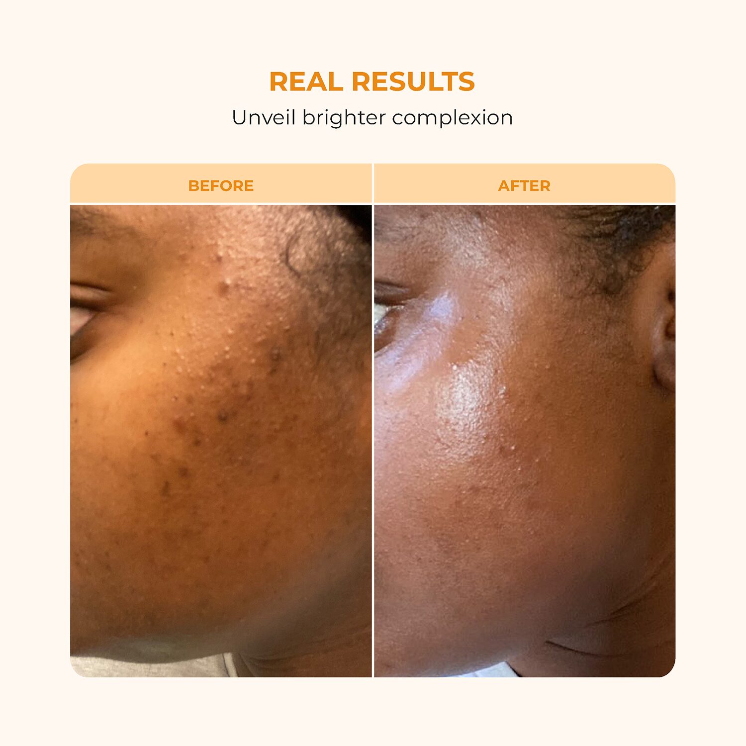 Buttah Skin Vitamin C Serum Face Serum