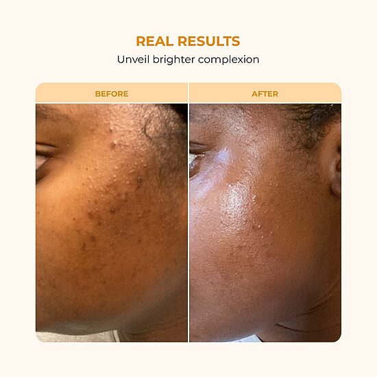 Buttah Skin Vitamin C Serum Face Serum