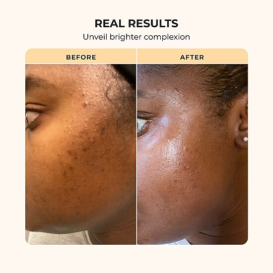 Buttah Skin 3 Piece Skin Transforming Set With Oil Free Hylaluronic Gel