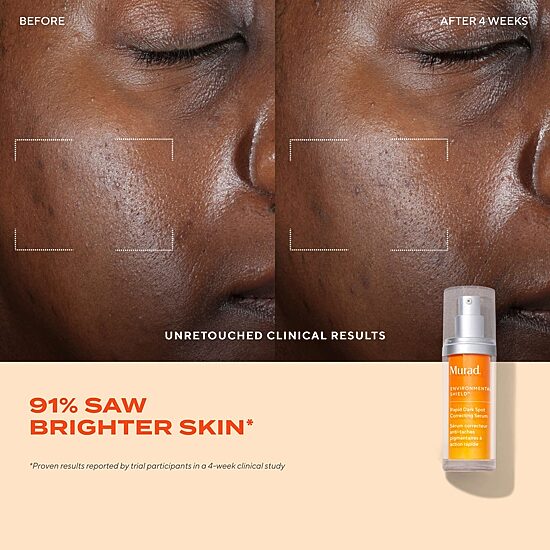 Murad Rapid Dark Spot Correcting Serum Face Serum