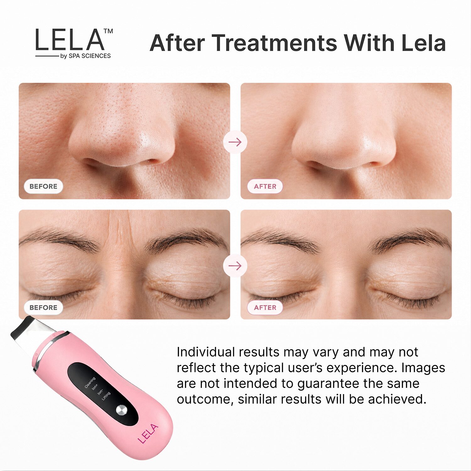 Spa Sciences Lela Ultrasonic Skin Spatula