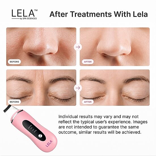 Spa Sciences Lela Ultrasonic Skin Spatula