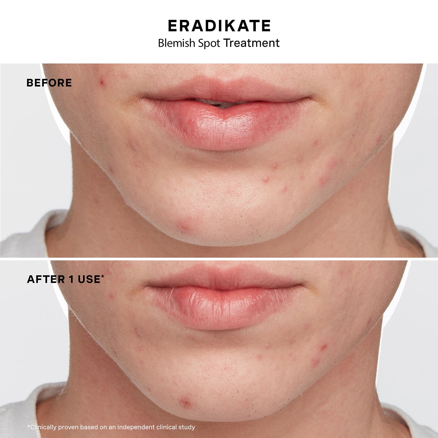 Kate Somerville Clear Skin Edit