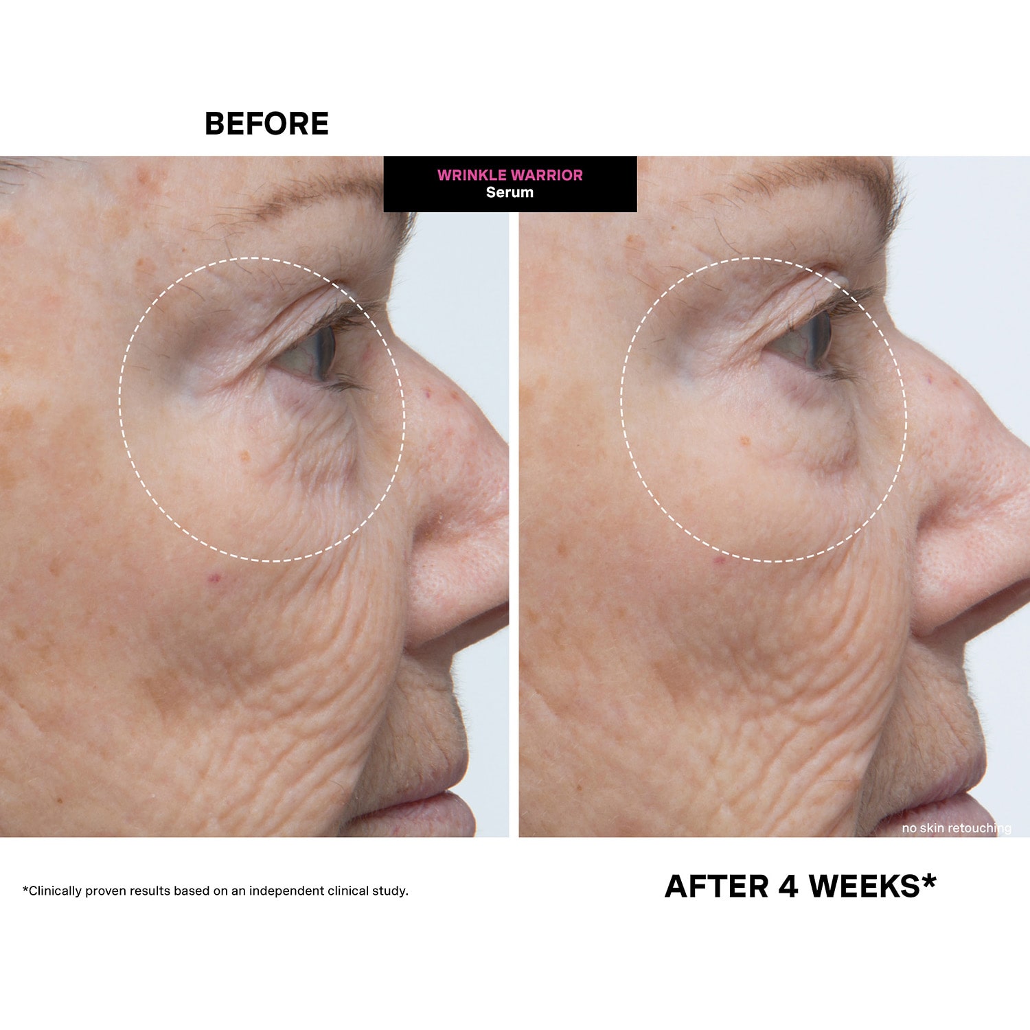 Kate Somerville Wrinkle Warrior® 2-In-1 Plumping Serum + Facial Moisturizer