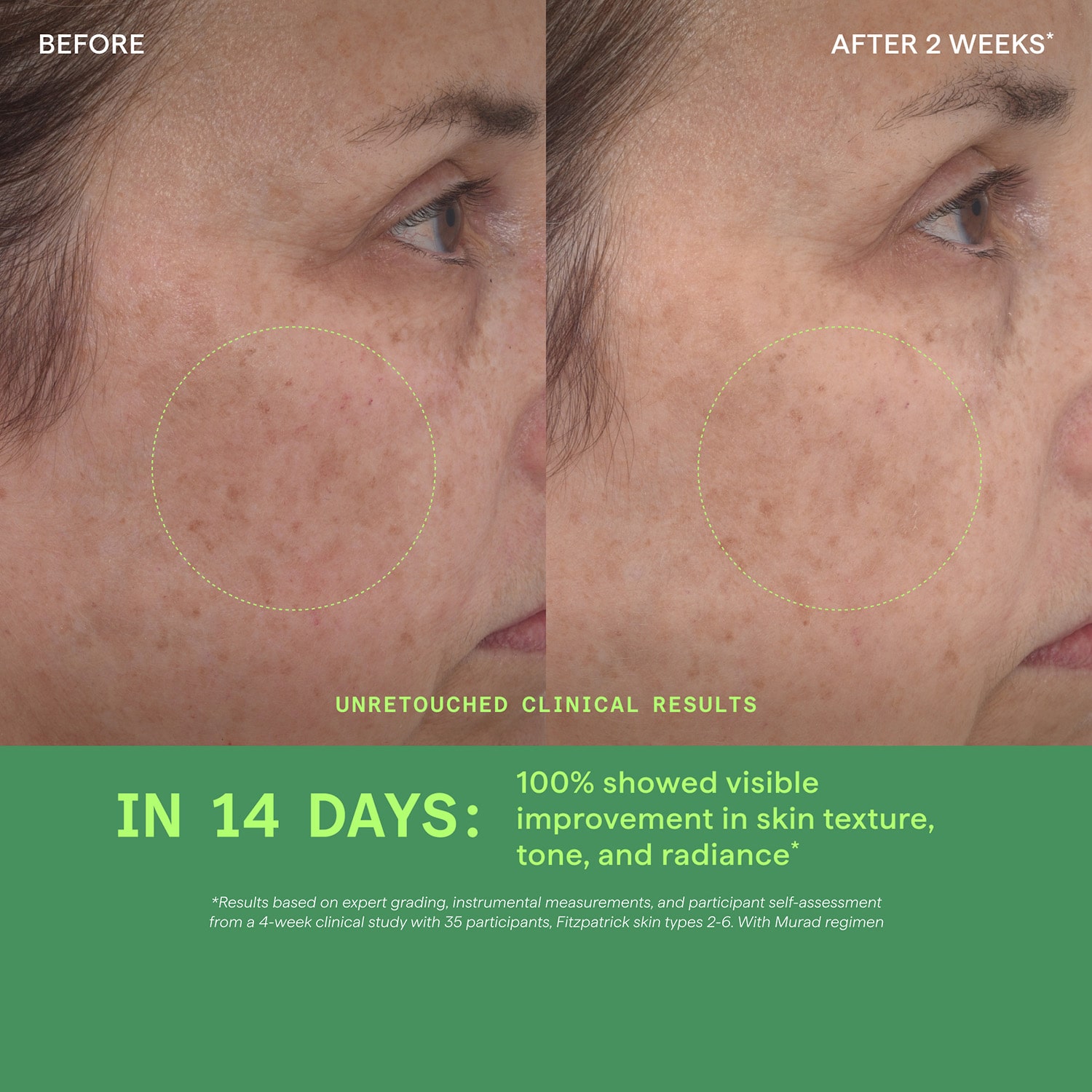 Murad Retinol Youth Renewal Serum Facial Serum