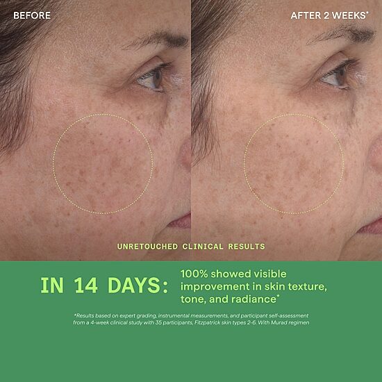 Murad Retinol Youth Renewal Serum Facial Serum