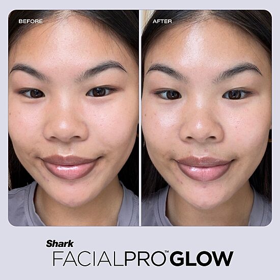 Shark BEAUTY™ Facialpro™ Glow At Home Facial System