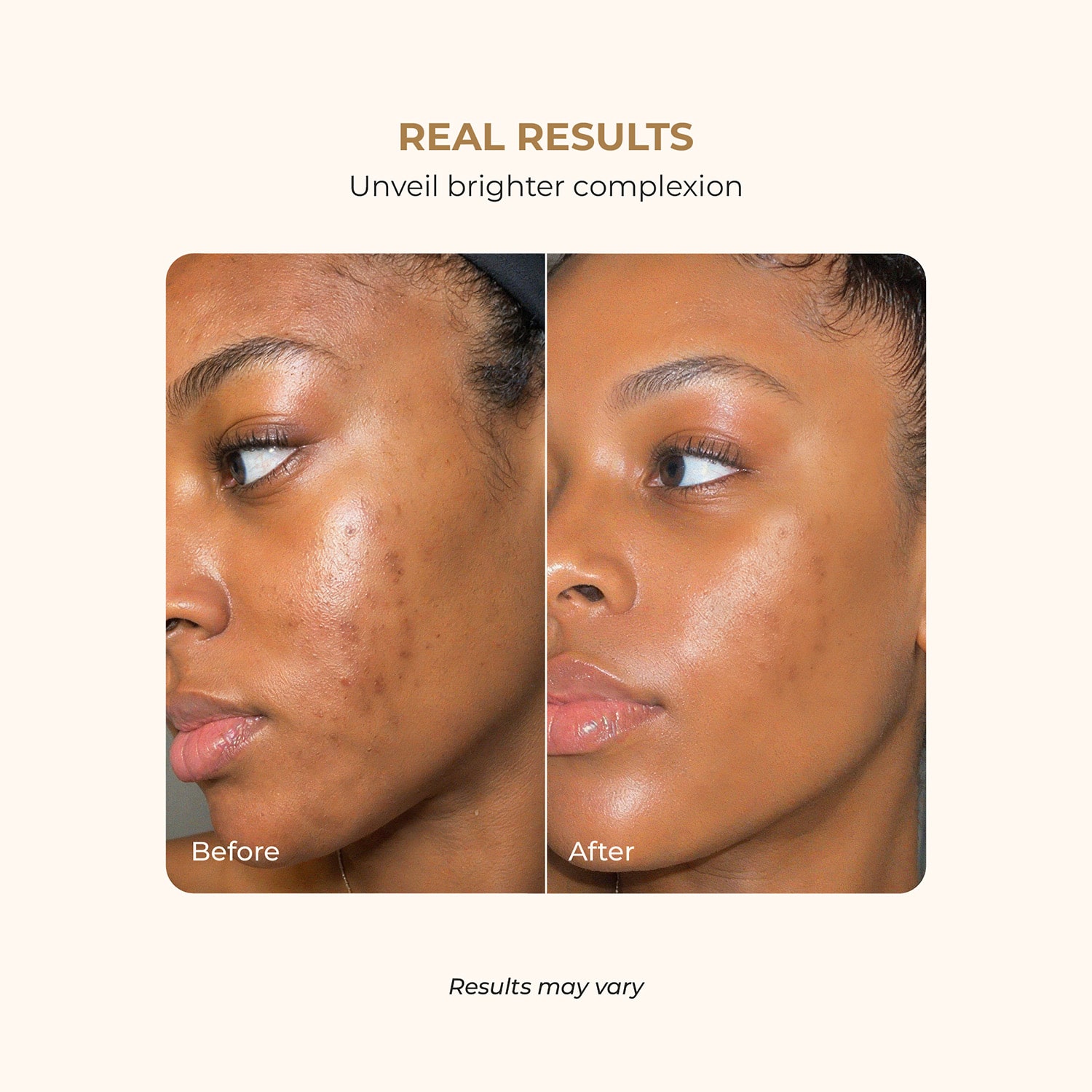 Buttah Skin Glow Essentials Mini Skincare Discovery Set