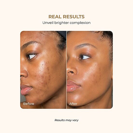Buttah Skin Glow Essentials Mini Skincare Discovery Set